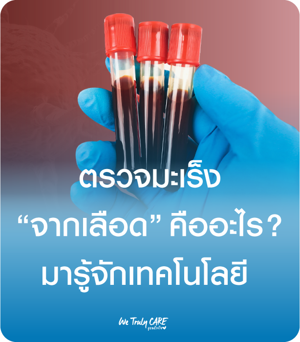 “ตรวจมะเร็งผ่านเลือด” คืออะไร? รู้จักเทคโนโลยีคัดกรองมะเร็งยุคใหม่
